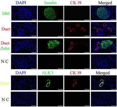 Pancreatic Duct Cells Isolated From Canines Differentiate Into Beta-Like Pancreatic Islet Cells